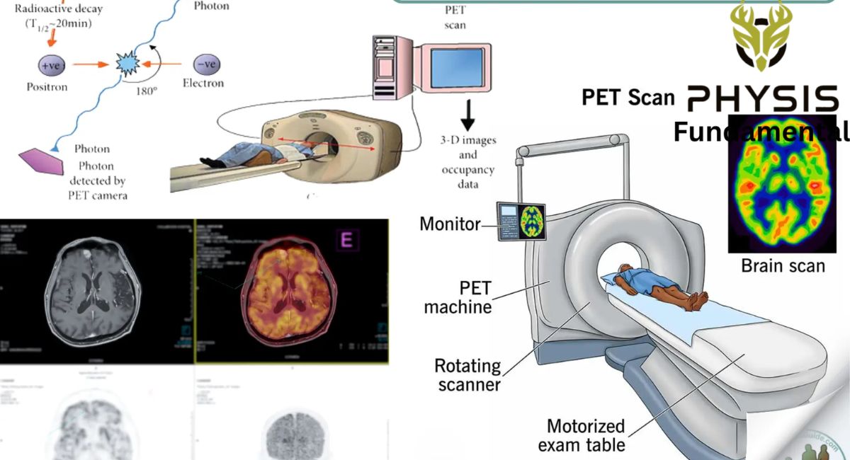 Positron Emission Tomography