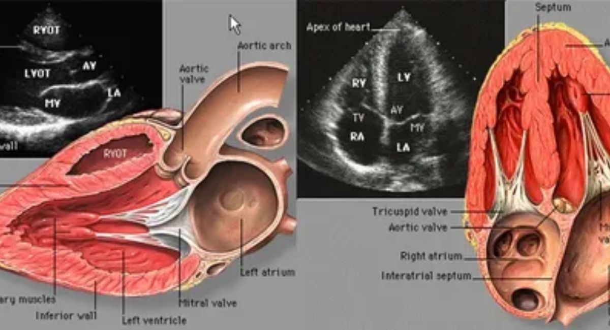 Echocardiography