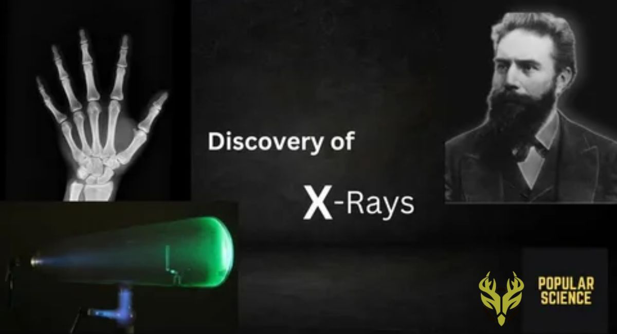 x rays